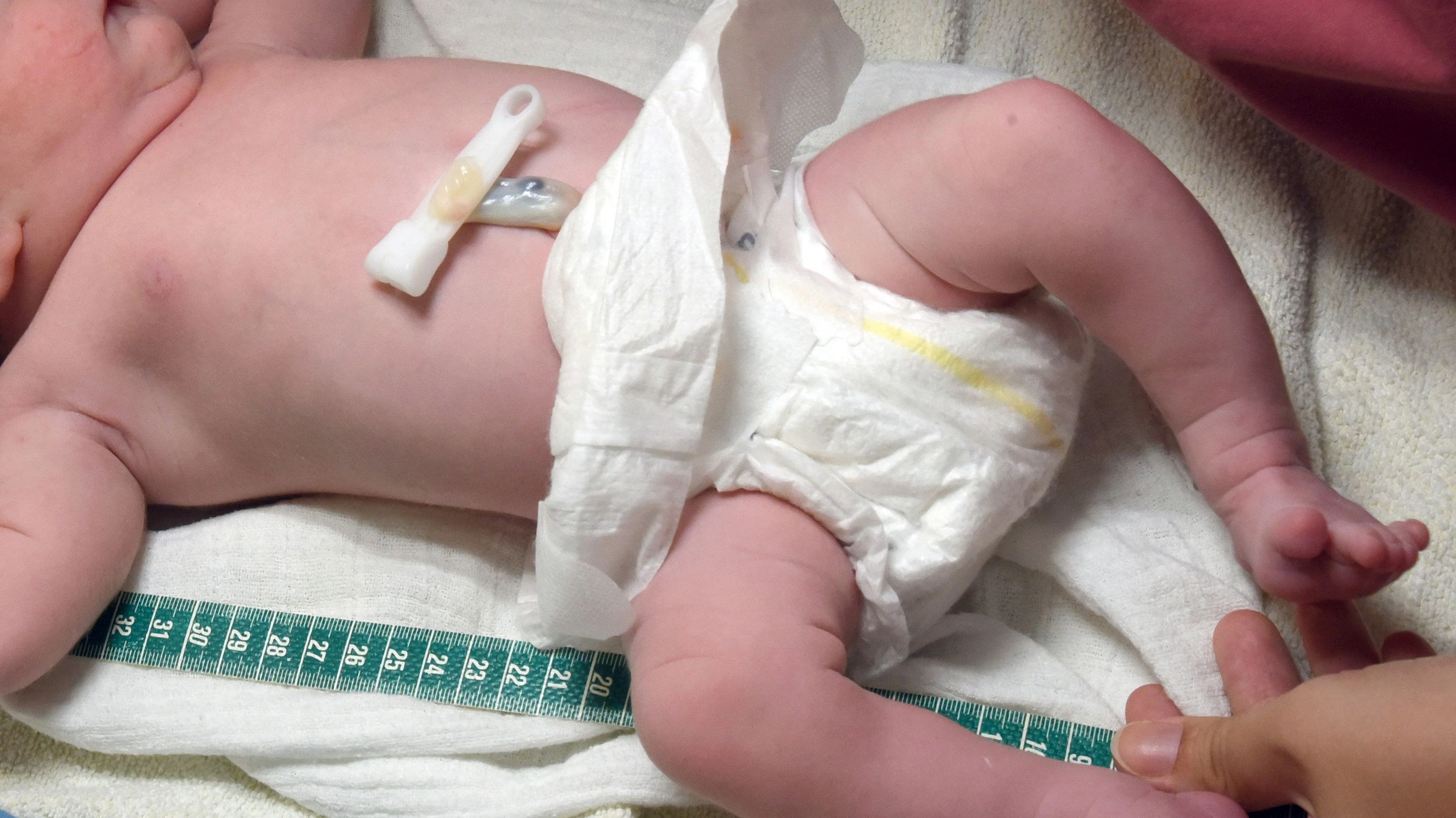 F. A. Z. Podcast für Deutschland: Neue Hebammen-Krise? „Dann kriegen alle Frauen Kaiserschnitte“ F. A. Z. Podcast für Deutschland: Neue Hebammen-Krise? „Dann kriegen alle Frauen Kaiserschnitte“