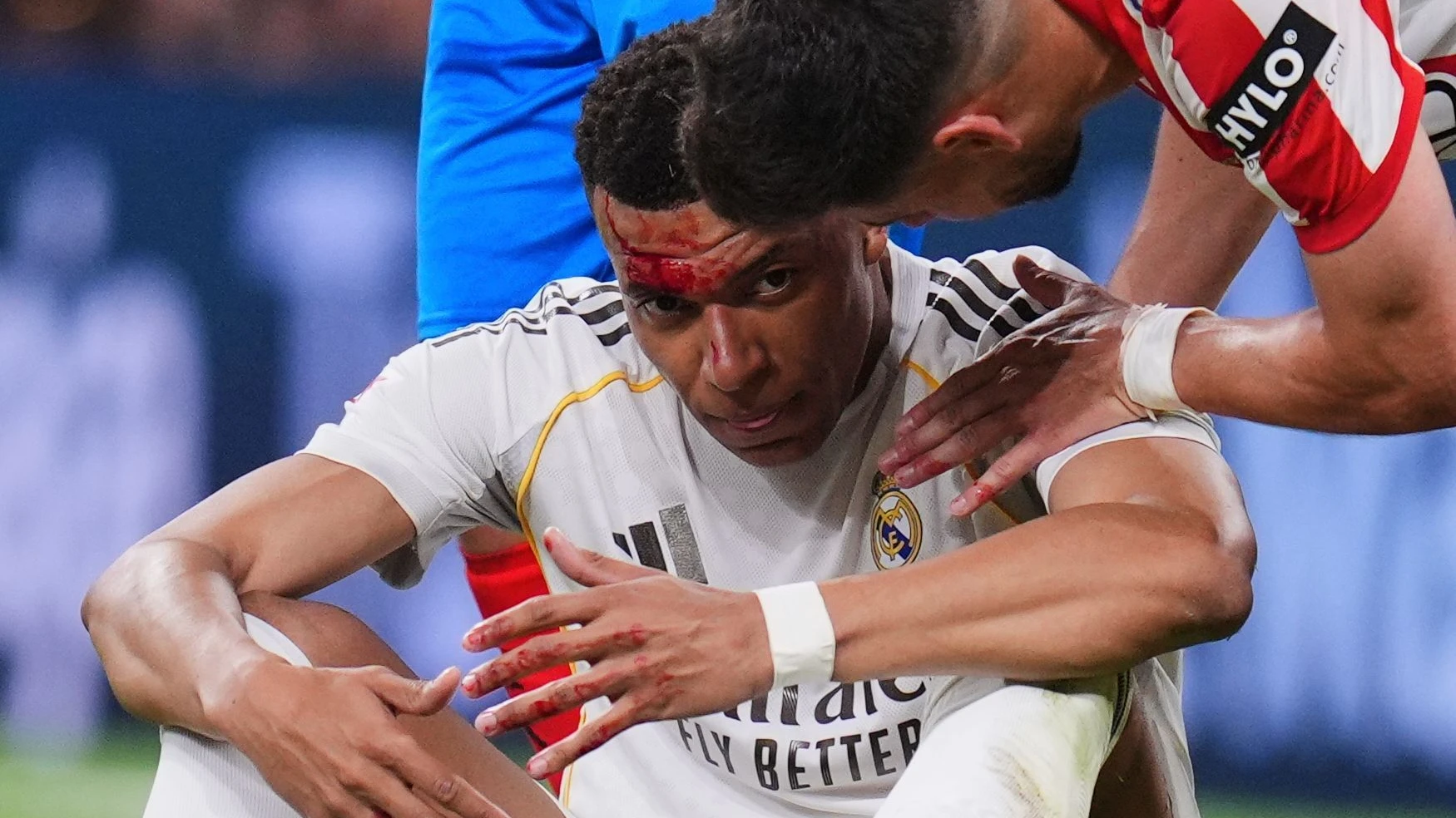 Nach Kopfwunde: Stürmerstar Mbappé wohl fit für Rückspiel gegen Bayern