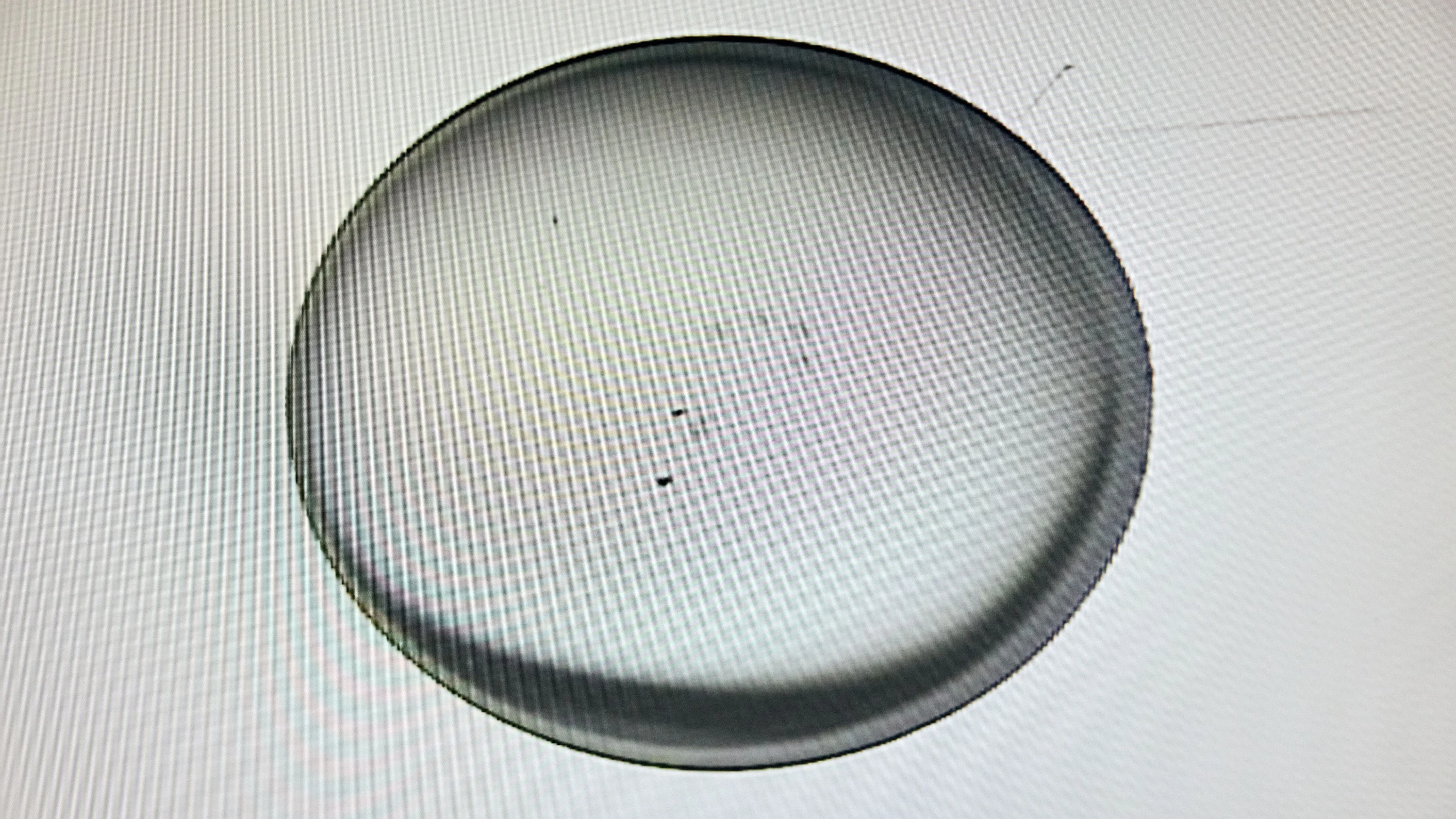 Reproduktionsmedizin: Akademikerin, 36 Jahre, Partner mit gutem Spermiogramm