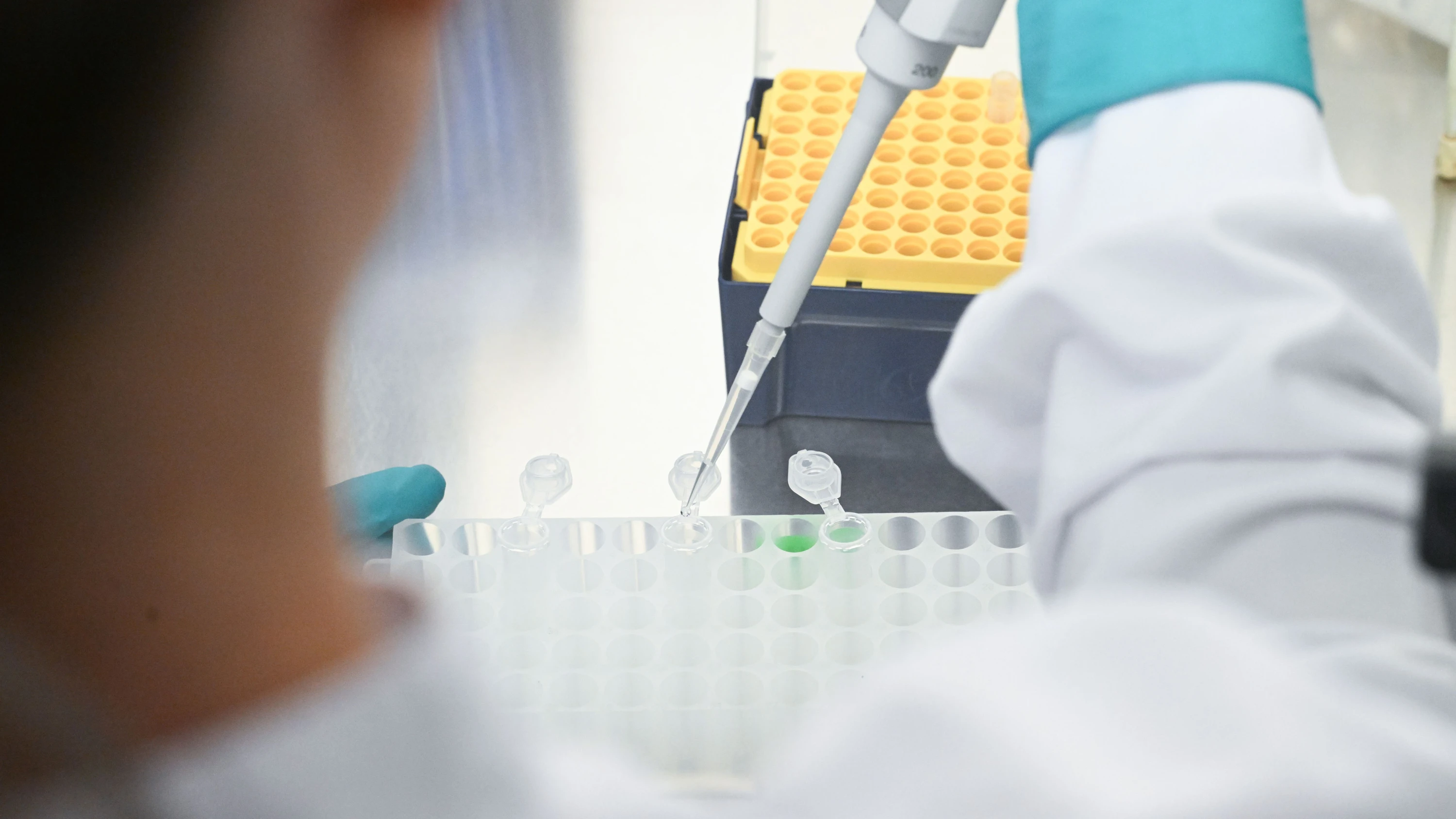 Standortschließungen: Biontechs Aufbruch hat seinen Preis