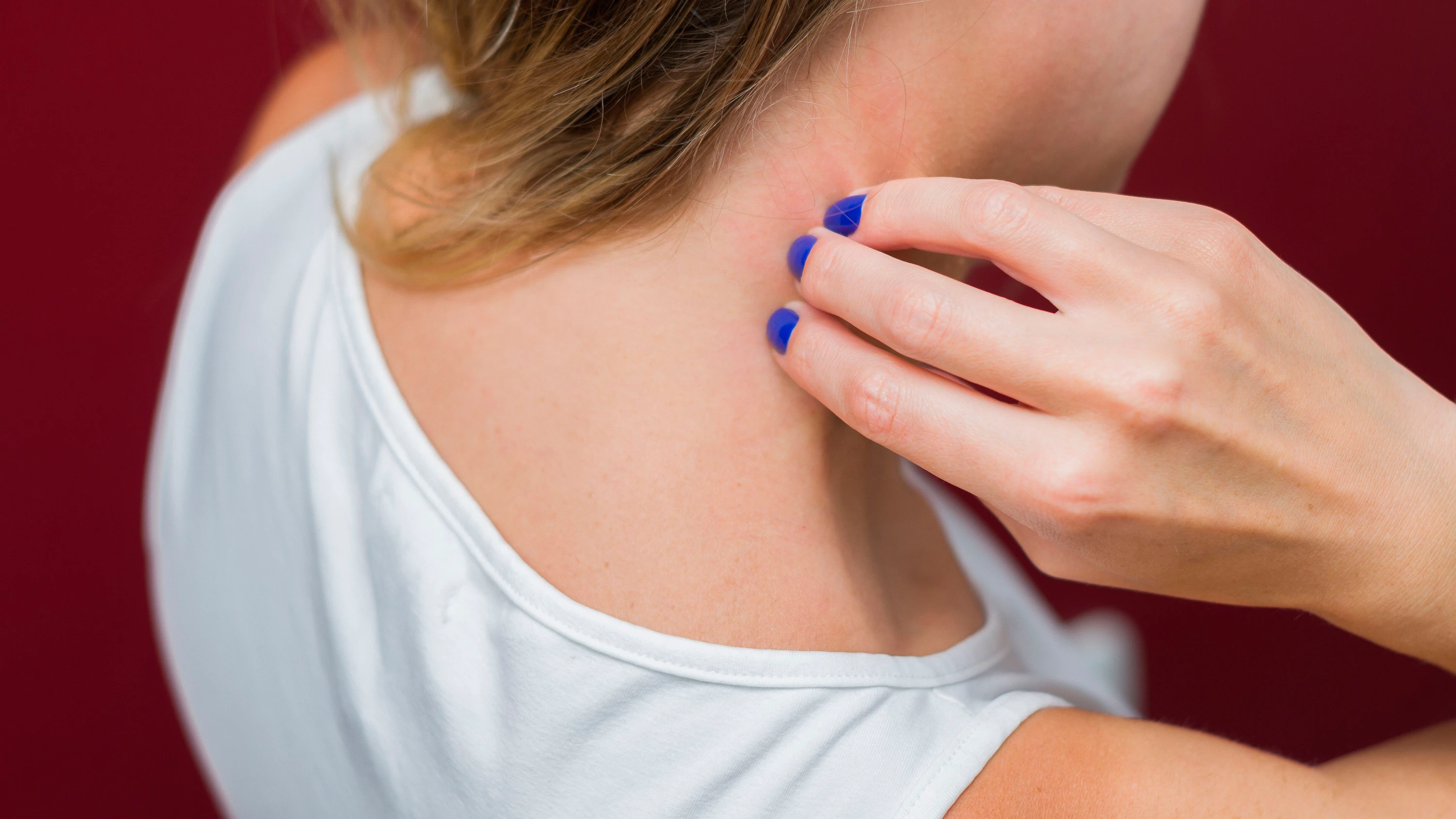 Symptome und Therapie: Die häufigsten chronischen Hauterkrankungen – und wie sie behandelt werden Symptome und Therapie: Die häufigsten chronischen Hauterkrankungen – und wie sie behandelt werden