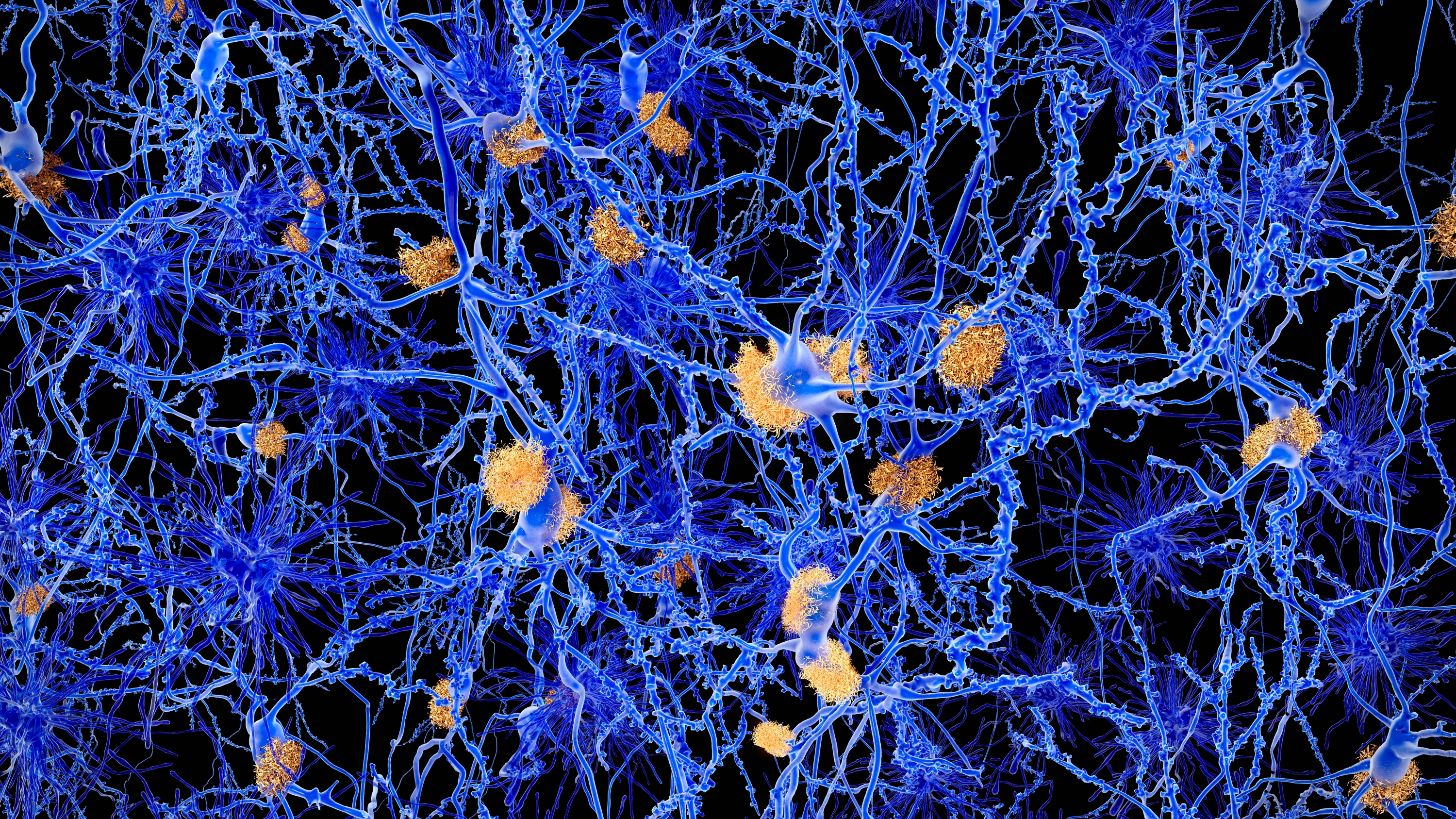 Schlaf und Neurologie: Ein neues Medikament gegen Narkolepsie wird zur Hoffnung der Hirnforschung Schlaf und Neurologie: Ein neues Medikament gegen Narkolepsie wird zur Hoffnung der Hirnforschung