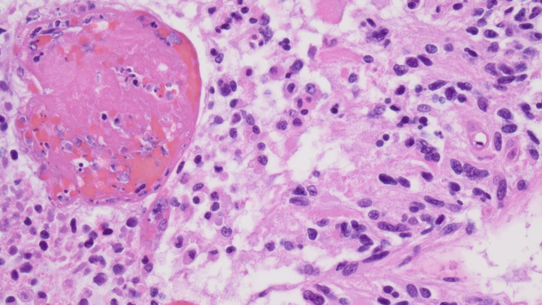 Paul-Ehrlich-Nachwuchspreis: Dem Hirntumor den Strom abstellen