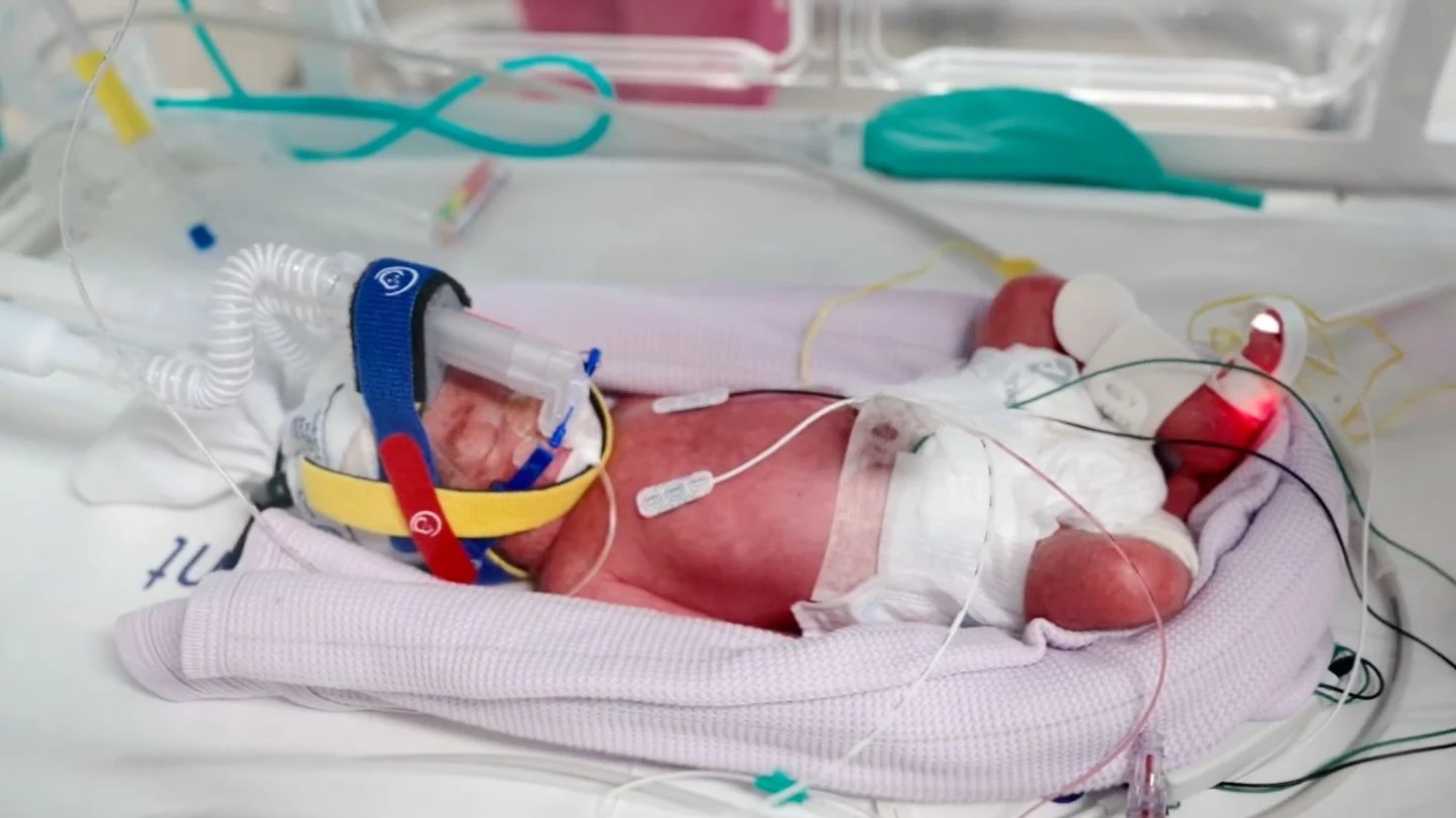 Chance 1:15 Millionen: Eineiige Vierlinge in Australien geboren