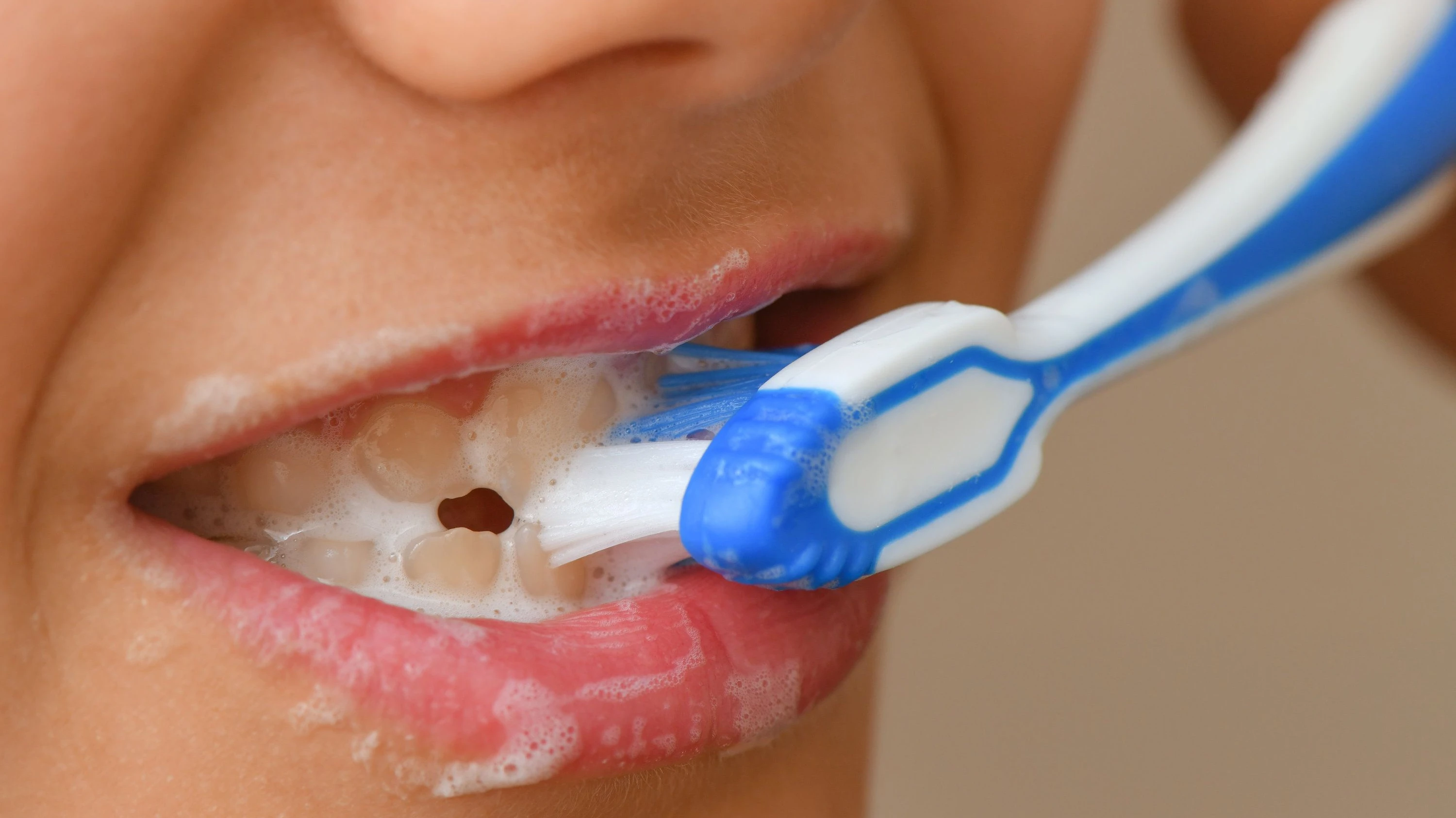 Tipps zur Zahnhygiene: So schützen Sie sich vor Parodontitis Tipps zur Zahnhygiene: So schützen Sie sich vor Parodontitis