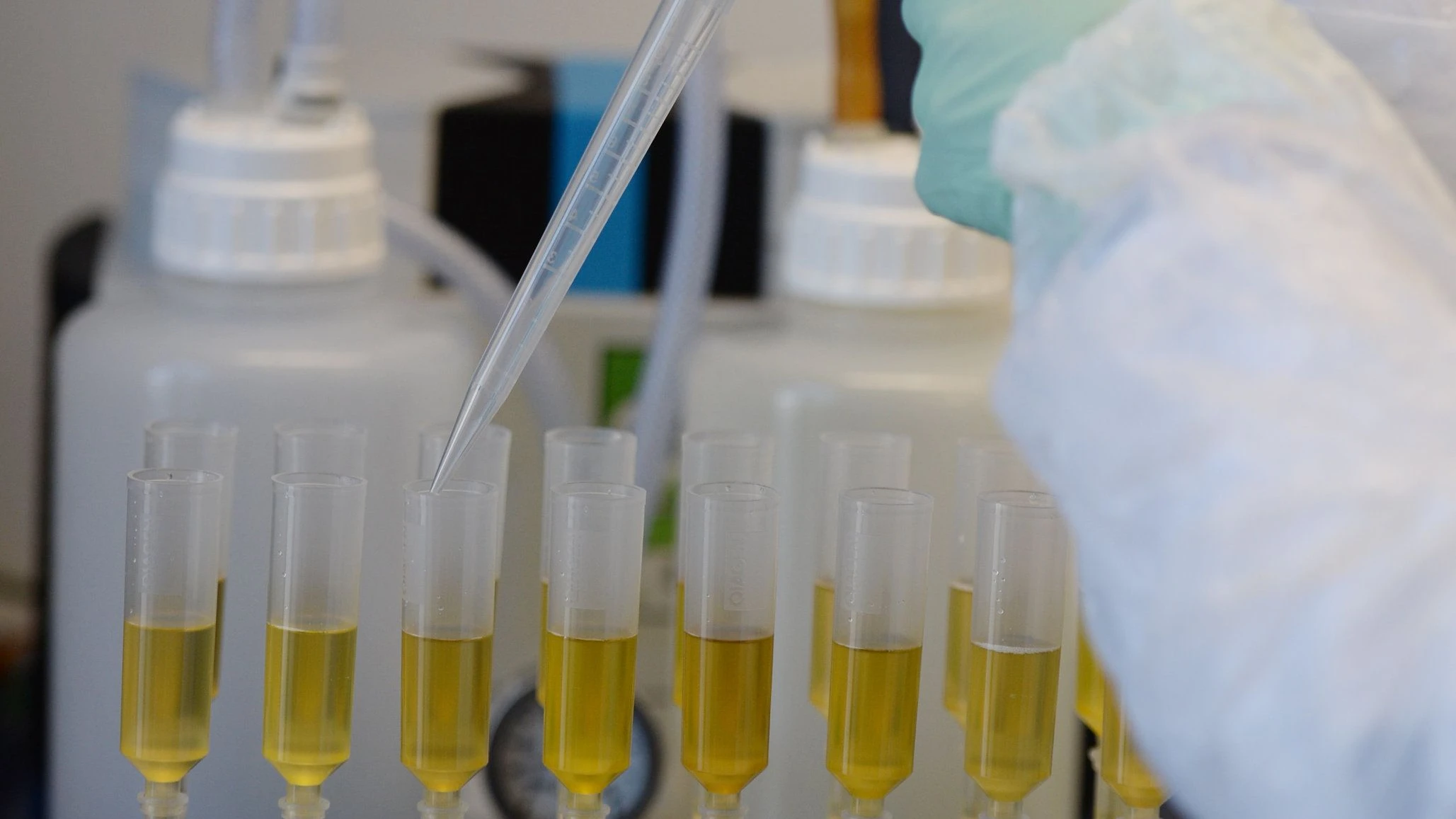 Trisomie-Tests: „Wir reduzieren genetische Vielfalt mit technischen Möglichkeiten“