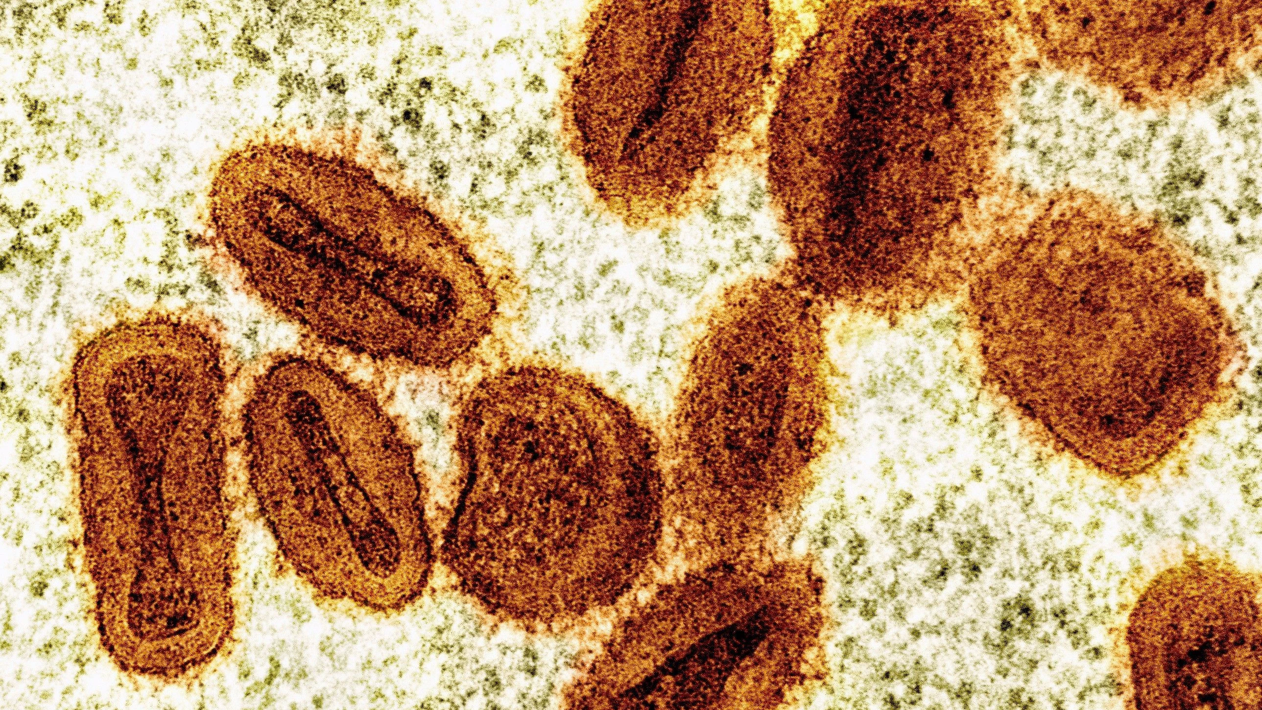 Übertragung erforscht: Sperma bahnt Mpox-Viren den Weg