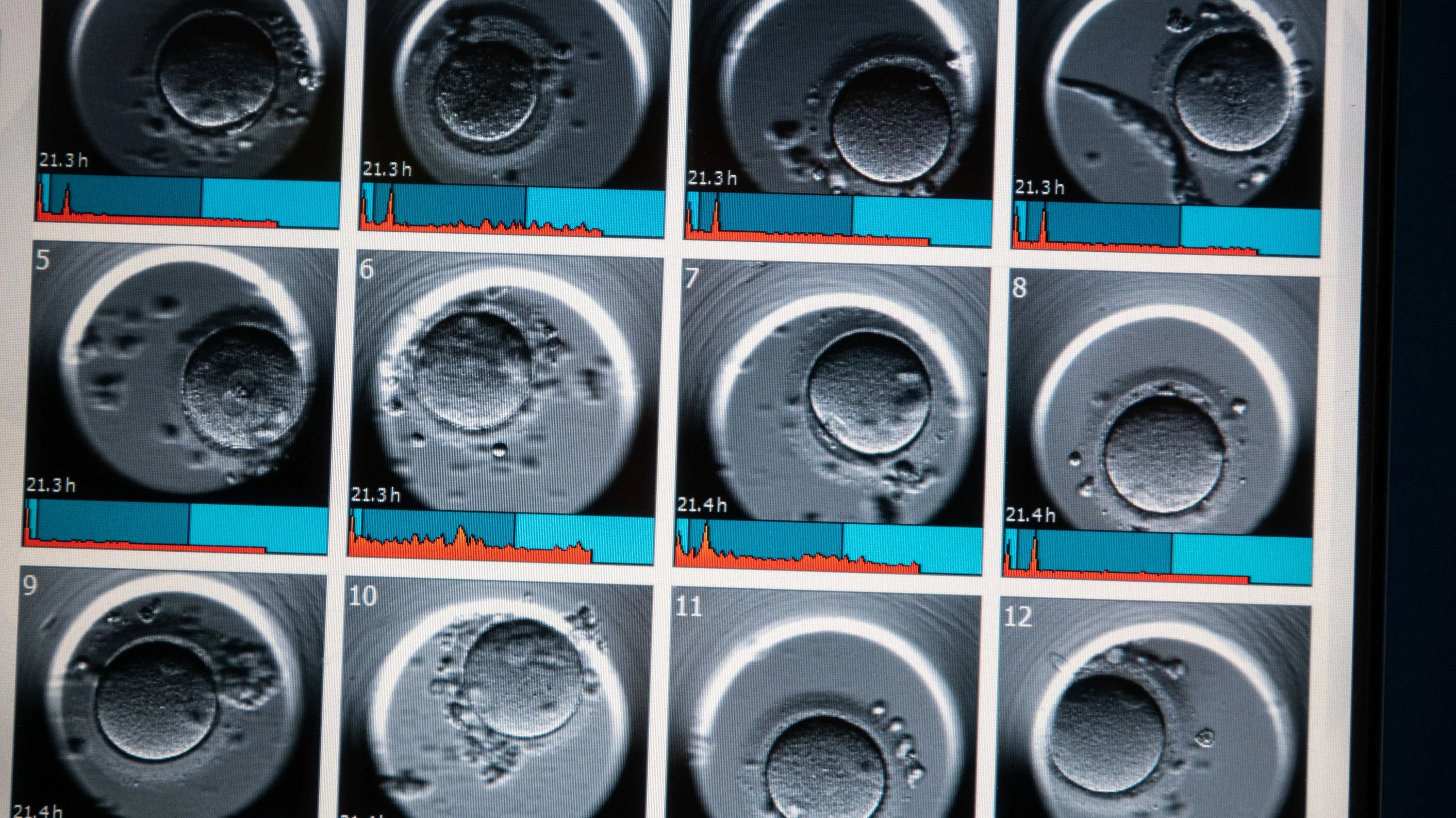 Umstrittene Gen-Eingriffe: Topgenetiker lehnt Design von Embryonen ab