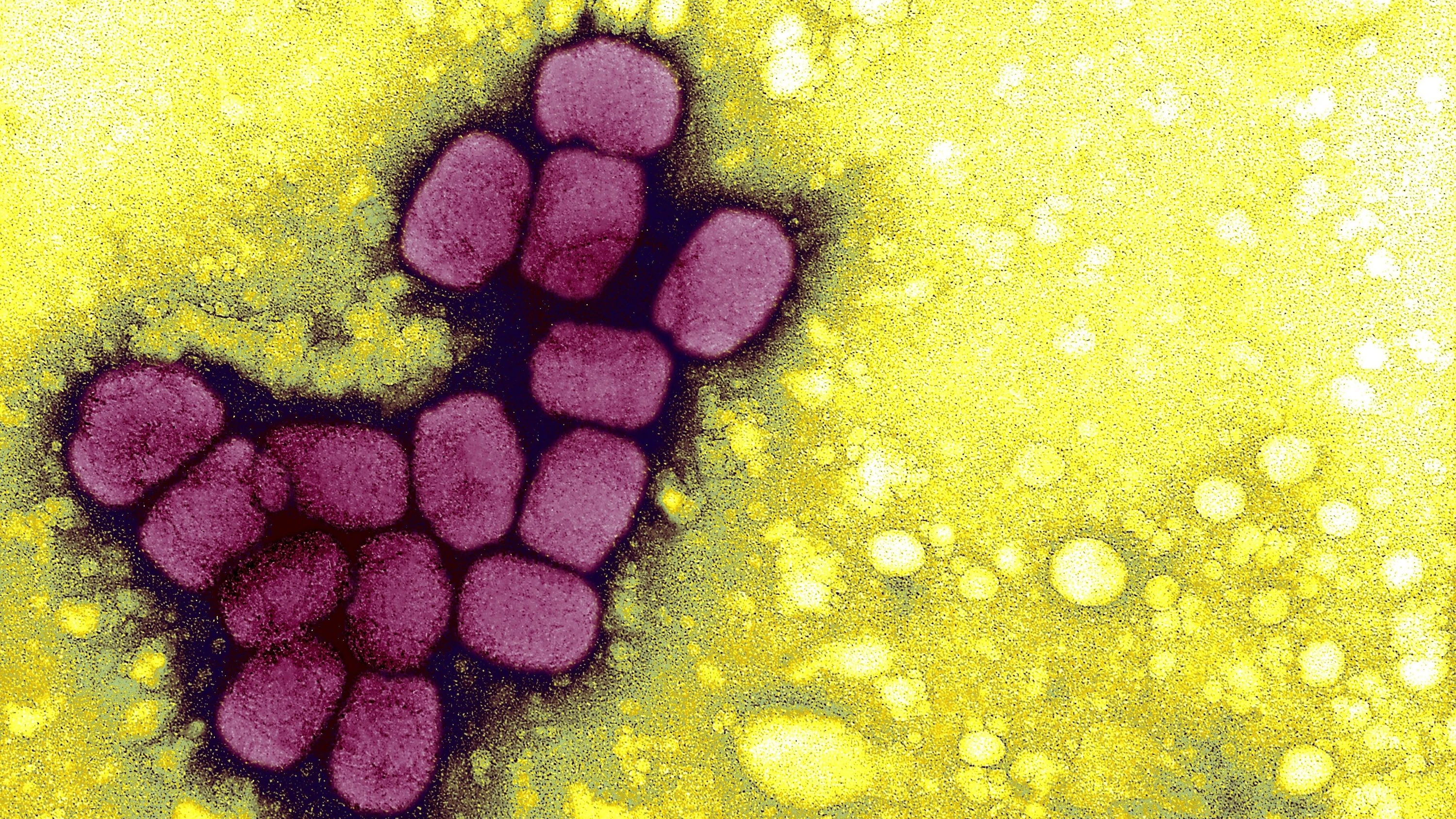 Biosicherheit: Blind für die Gefahr? Biosicherheit: Blind für die Gefahr?
