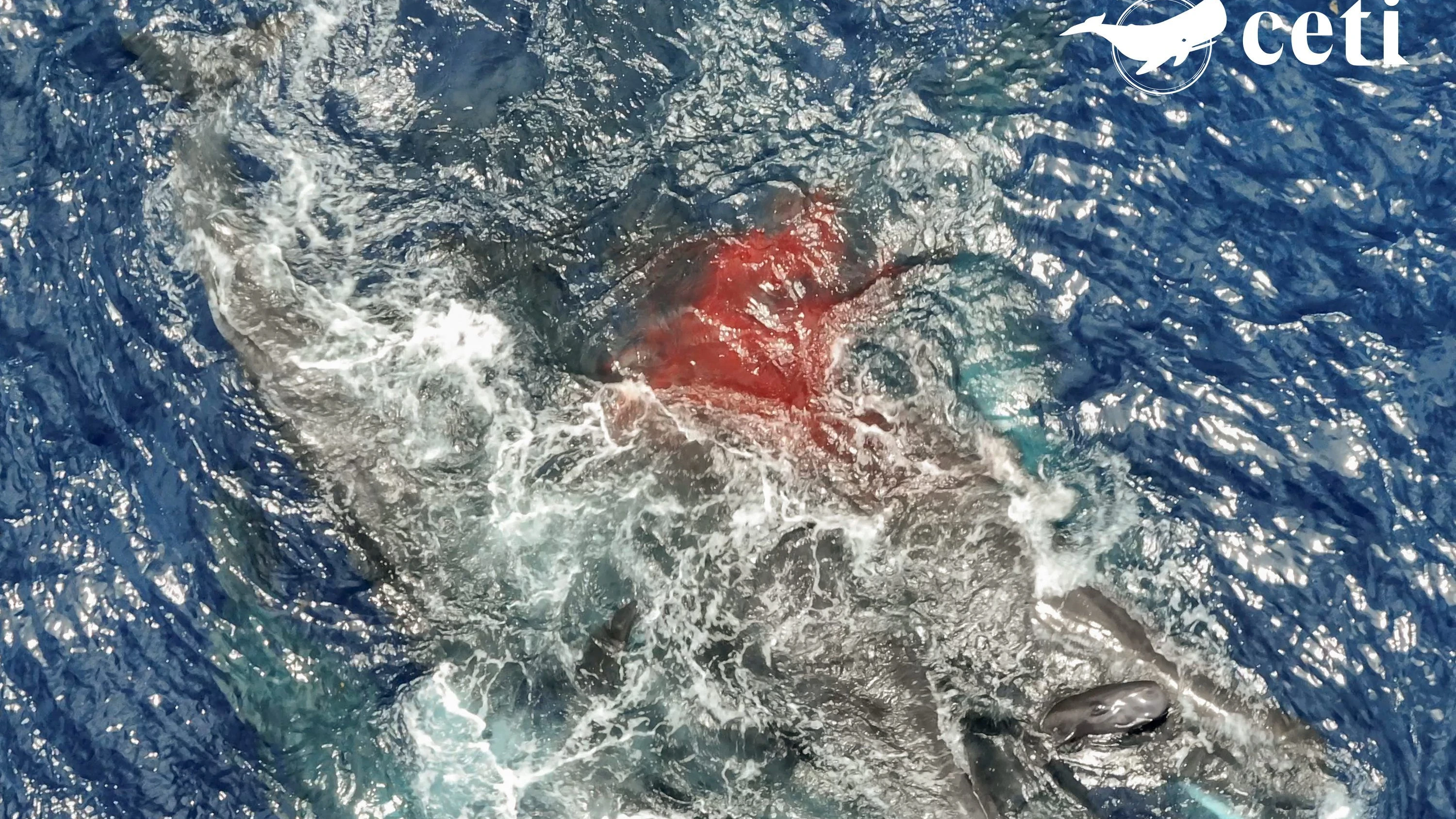 Walgeburt im Video: „Und plötzlich war da eine Menge Blut“ Walgeburt im Video: „Und plötzlich war da eine Menge Blut“