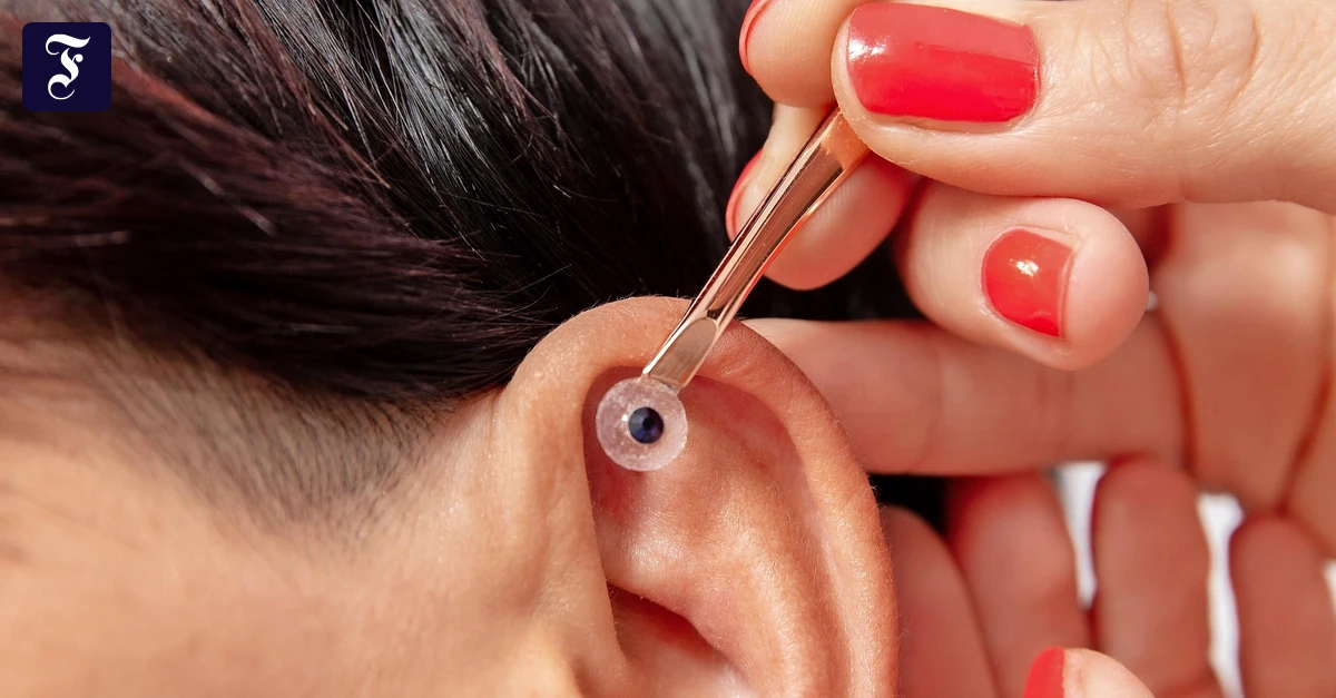 Beauty-Trend aus Korea: Machen Ear Seeds wirklich schöner?