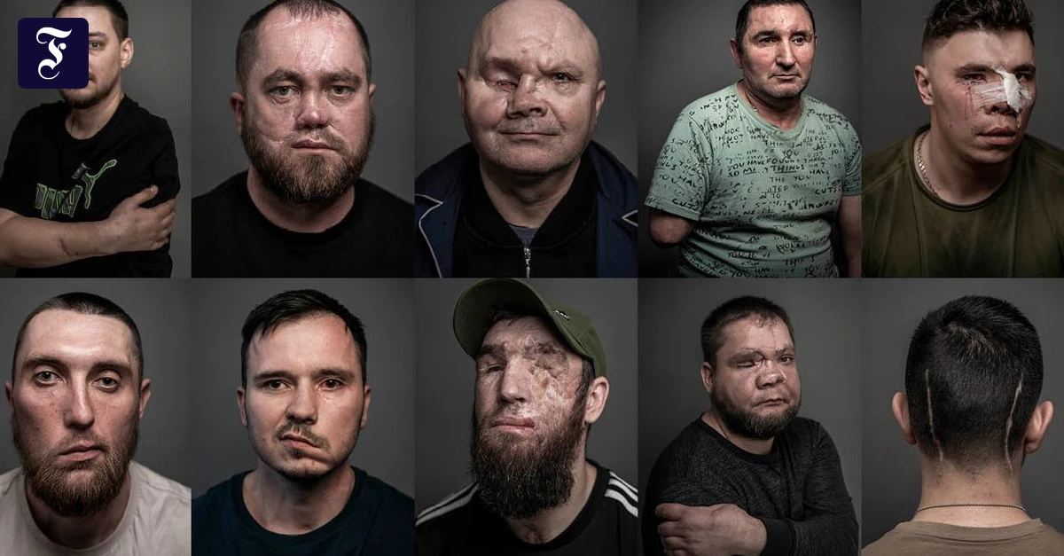 Gesichter des Krieges: Verwundete in der Ukraine