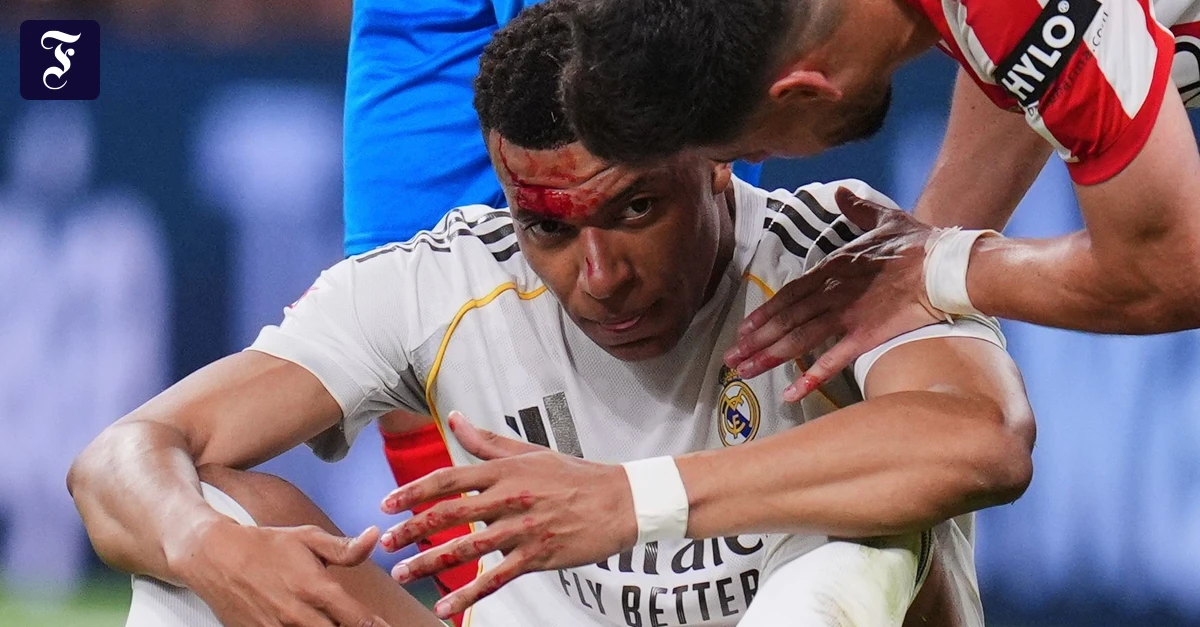 Real Madrid's star striker Mbappé likely fit for the second leg ...