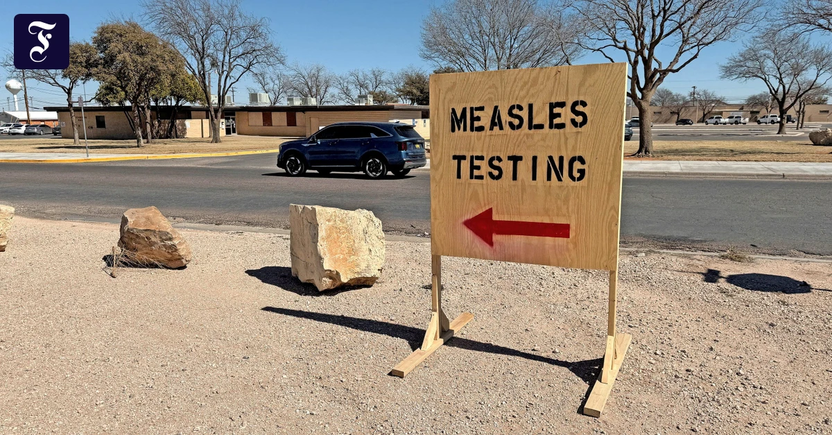 Masern-in-den-USA-Die-Masernf-lle-nehmen-zu-aber-auch-die-Impfskepsis