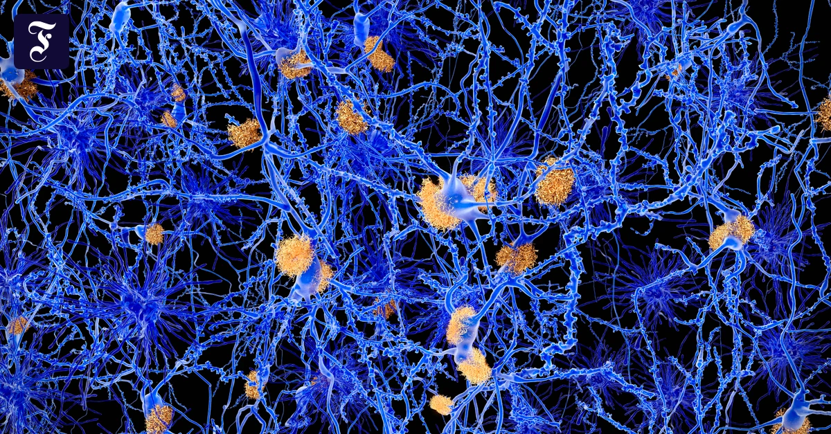 A new narcolepsy drug offers hope for brain research and neurology