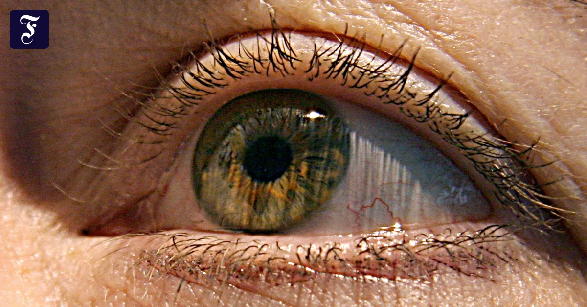 First eye chip for the blind is now approved in Europe