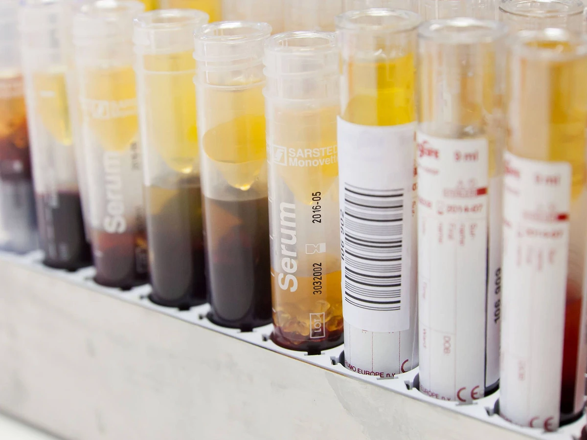 Blutplasma fr die Behandlung schwer erkrankter Coronapatienten | FAZ