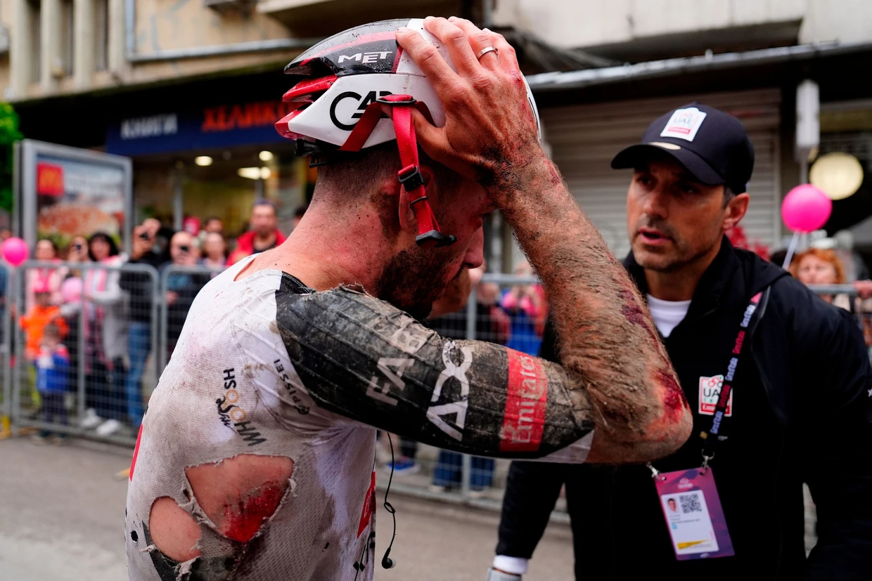 Vom Rennen gezeichnet: Adam Yates nach einem schweren Sturz zu Beginn der Rundfahrt