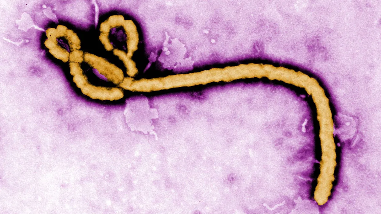 Gefährliches Virus: Ebola unterm Mikroskop