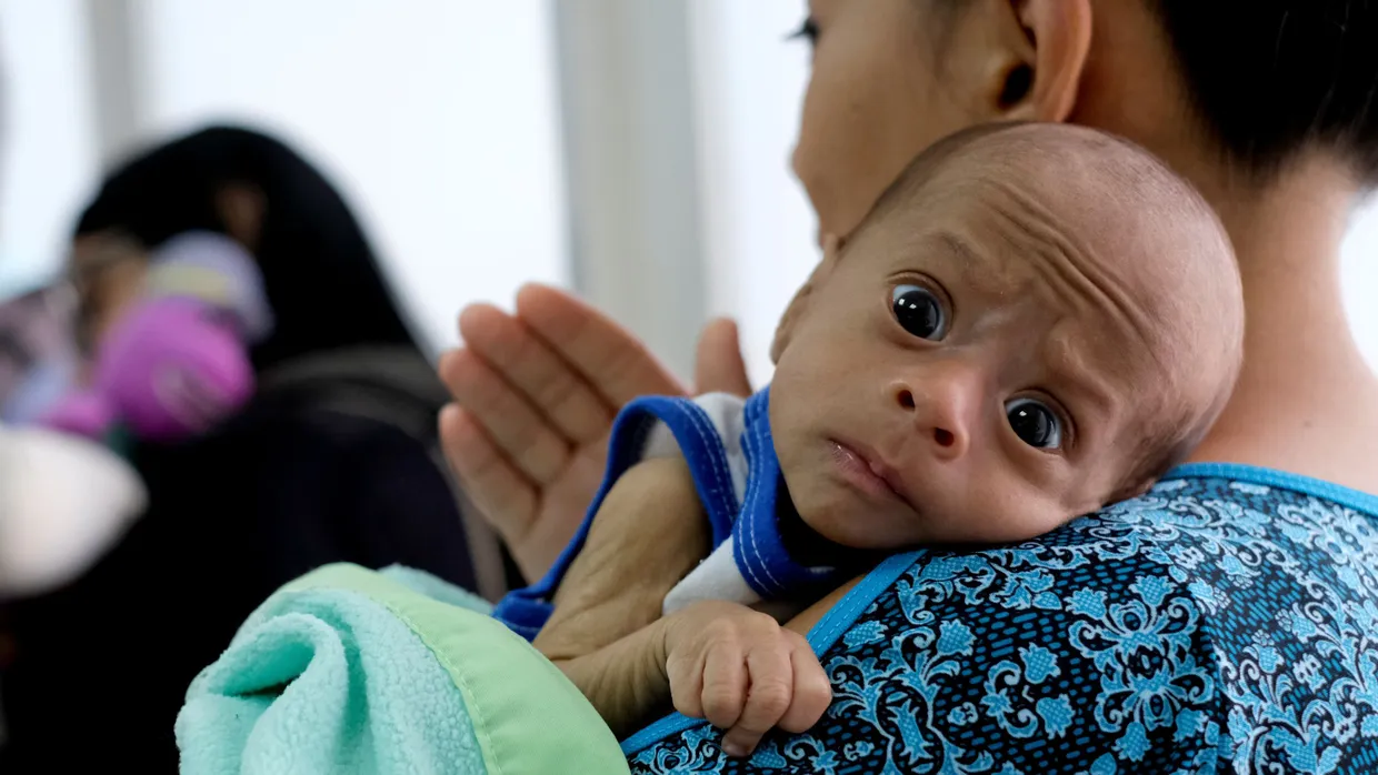 Venezuela ist eines der Länder, in denen Kinder Hunger leiden.