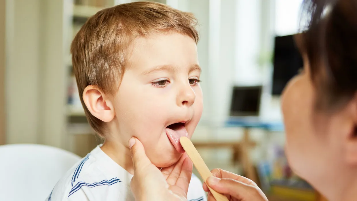 Scharlach sorgt bei Kindern für typischen Ausschlag auf der Zunge.