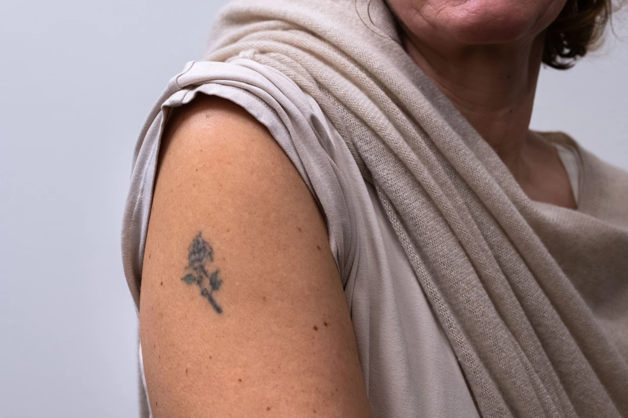 Melanie Zink ließ sich ihr Rosen-Tattoo mit 18 Jahren stechen. Jetzt, da sie 52 Jahre alt ist, will sie es entfernen lassen.
