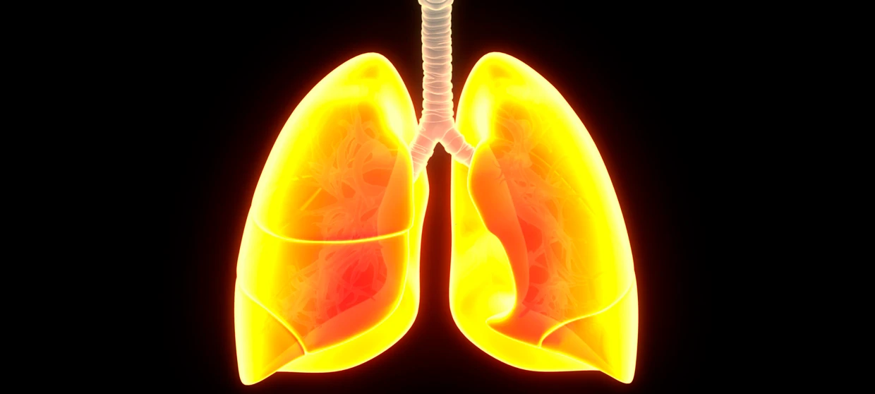 Neuer Behandlungsansatz für schwere Lungenkrankheit Neuer Behandlungsansatz für schwere Lungenkrankheit