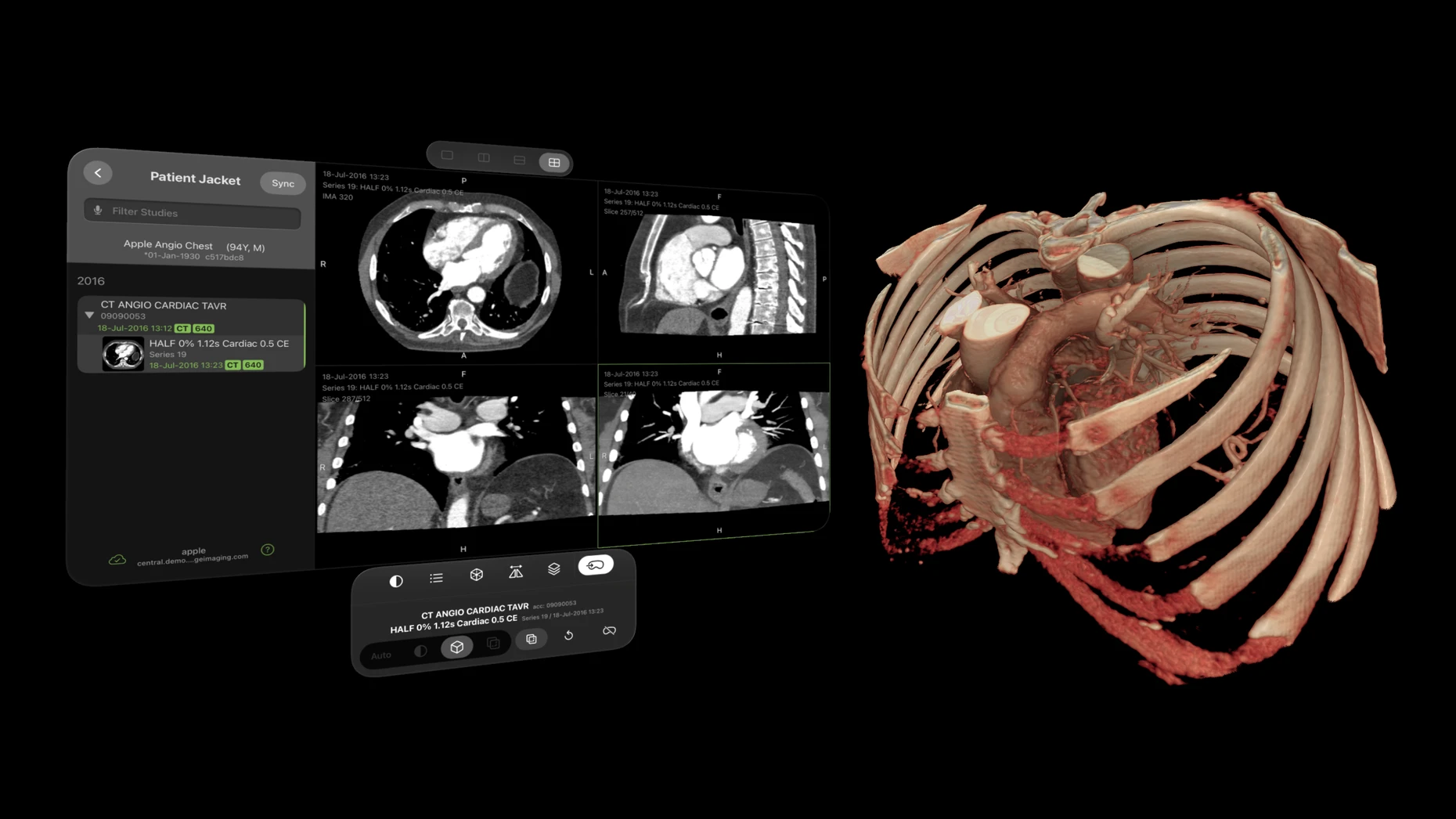 Alles gleichzeitig im Blick: Patientendaten, aktuelle Aufnahmen und eine 3D-Darstellung des Thorax