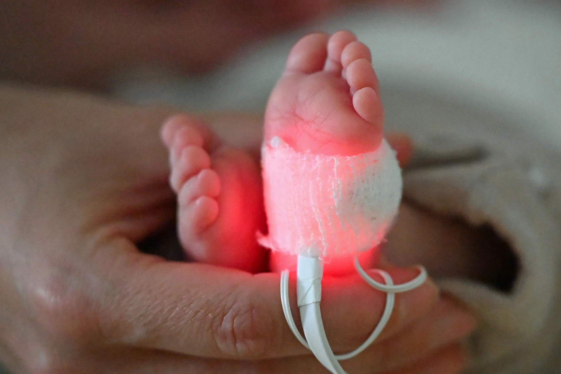 Frühchen stirbt nach Darmkeim-Infektionen in Kinderklinik in Paderborn