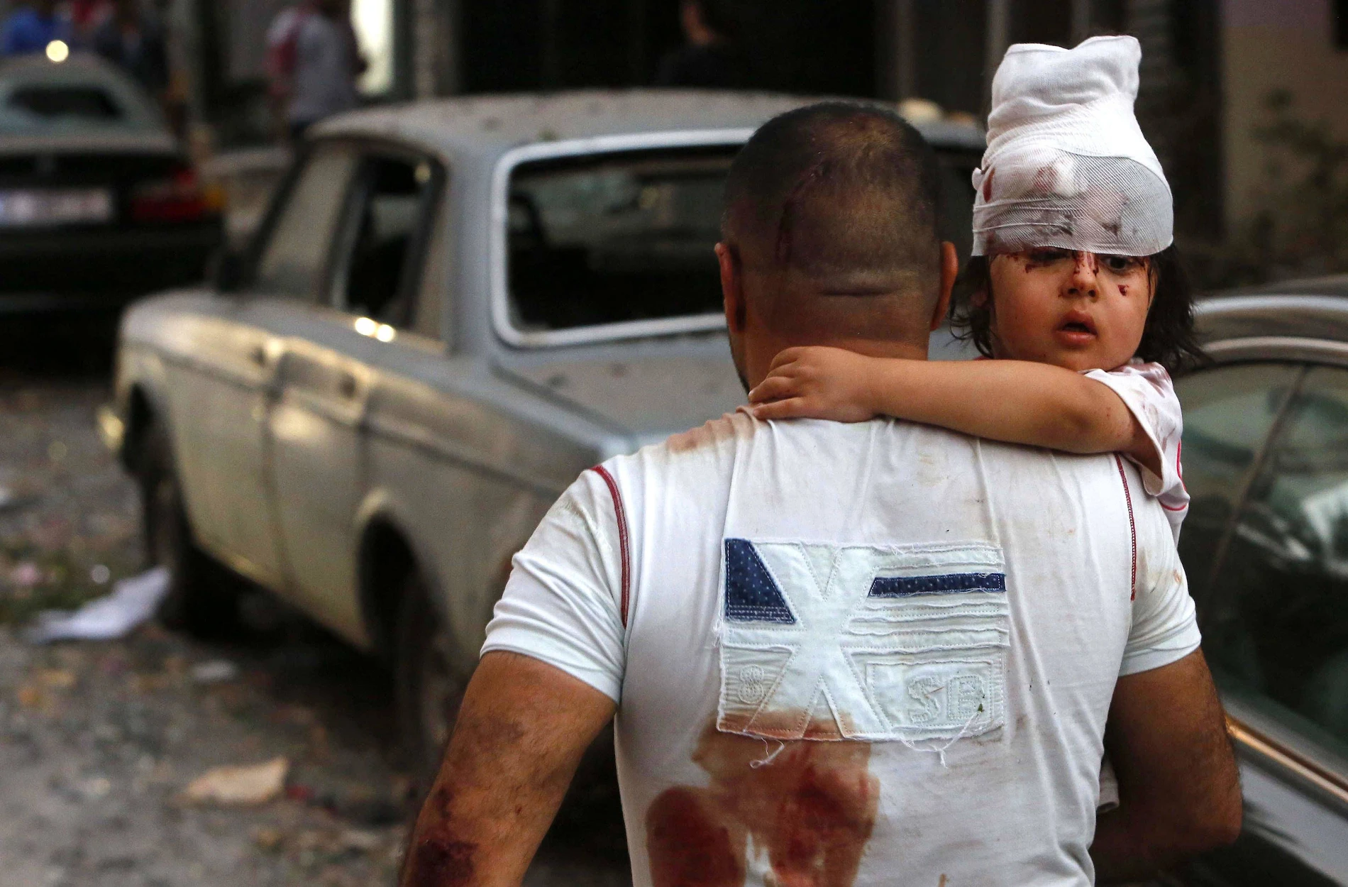 Ammoniumnitrat: Die Substanz der Explosion in Beirut | FAZ
