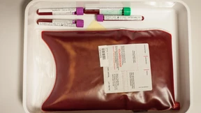 Mit Killerzellen den Blutkrebs schonender bekämpfen