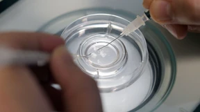 Krankenversicherung muss keine Eizellspende im Ausland bezahlen