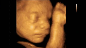 „Mit Bildern freut man sich noch stärker aufs Kind“ 