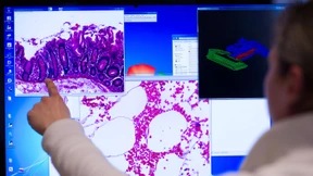 Ein Genatlas der Saboteure