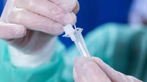 Deutliches Absinken von Corona-Fallzahlen zeichnet sich ab