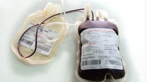 Tut etwas Blut immer gut?