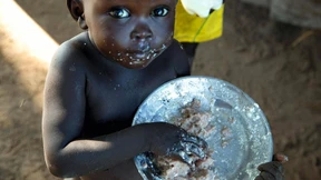Ist Unterernährung auch ein Immundefekt?