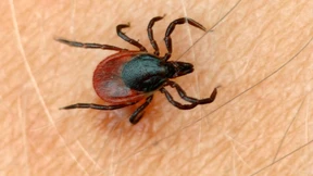 Viele US-Amerikaner haben von Zecken verursachte Fleischallergie