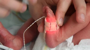 Frühchen-Versorgung: Wie gut ist die moderne Medizin?