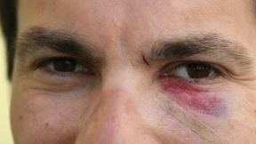 Hasskriminalität „in völlig neuer Dimension“