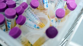 Umweltbundesamt bestätigt Weichmacher-Fund in Menschen