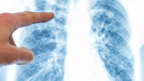 Was steckt hinter der Rekordzahl der Krankenversicherten?