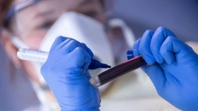 R-Wert sinkt unter 1 – weniger Neuinfektionen als in der Vorwoche