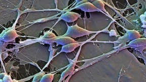 Wie ein natürliches Prinzip Nervenzellen robuster macht