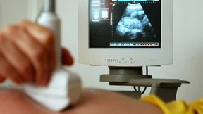 „So einfach bekommen wir den Schein nicht wieder“