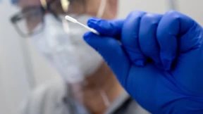 Unter diesen Bedingungen muss man zahlen