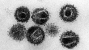 280 HIV-Neuinfektionen in Hessen