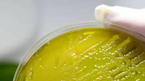 Der verflüchtigte Erreger