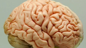 Wie man das Gehirn auch retten kann