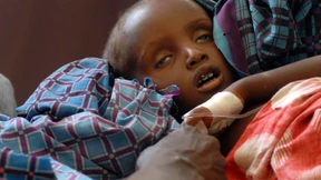 Unicef warnt vor Kinder-Massensterben in Ostafrika